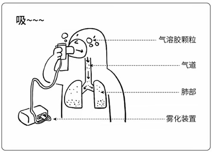 雾化吸入原理图片