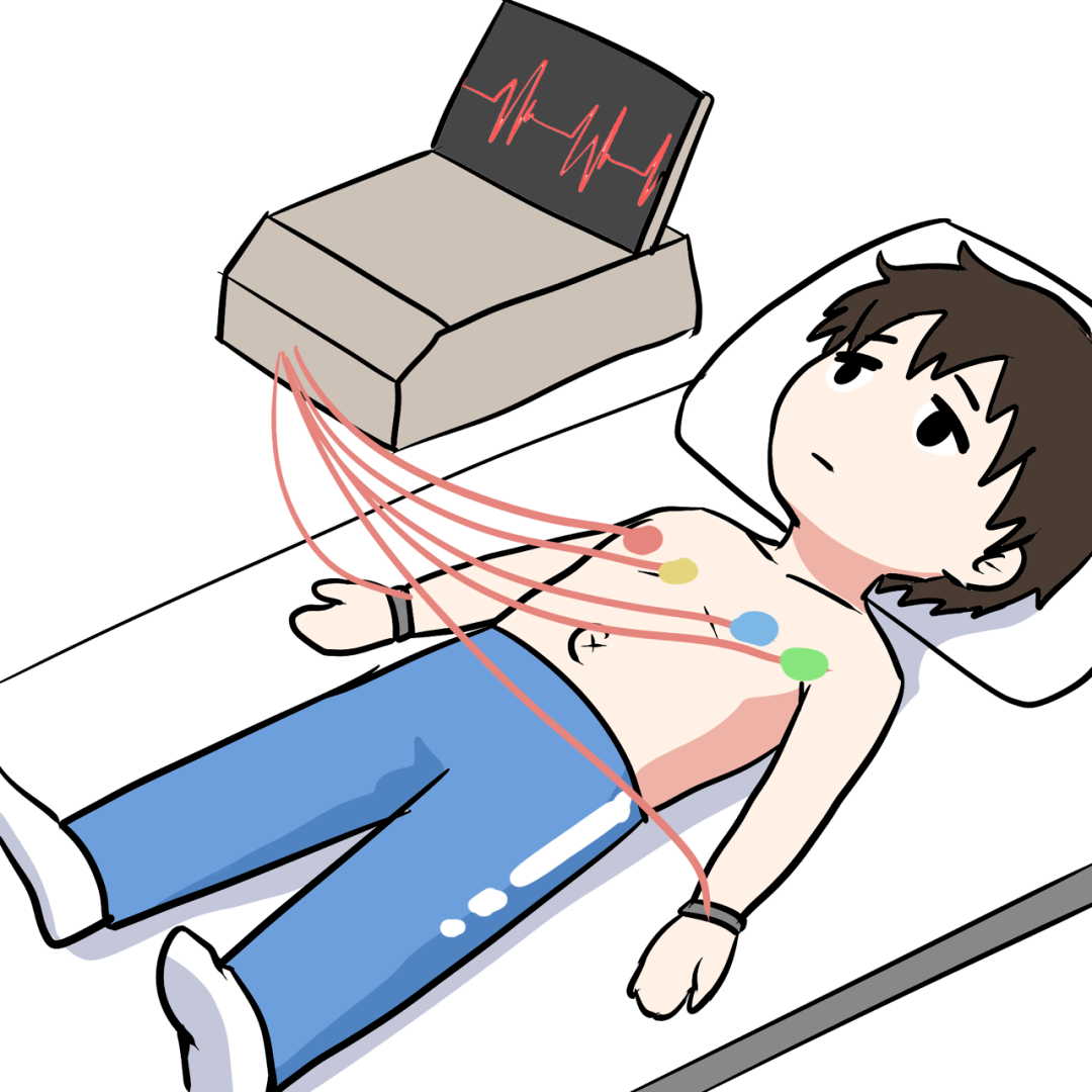 总之,24小时动态心电图是一种重要的非创伤性检查方法,通过连续监测